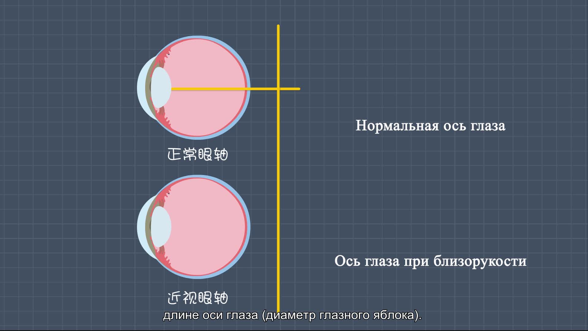 Близорукость тоже болезнь!--中国数字科技馆